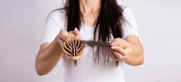 10 Tips Mengatasi Rambut Rontok Setelah Melahirkan