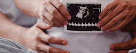 12 Fakta Mencengangkan Seputar Kehamilan