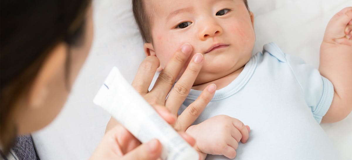 12 Rekomendasi Krim Ruam Popok Bayi Ibupedia