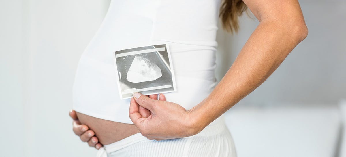 12 Tanda Janin Stres Saat Hamil Yang Perlu Ibu Waspadai Ibupedia