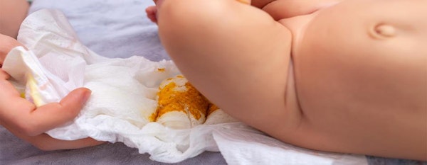 14 Fakta di Balik Warna dan Tekstur Feses Bayi