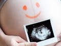 3 Cara Menghitung Usia Kehamilan, Mana yang Paling Akurat?