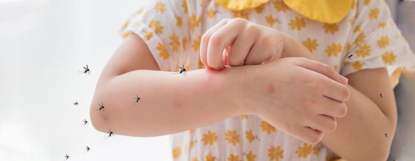 5 Tips Memilih Obat Anti Nyamuk Bayi yang Aman