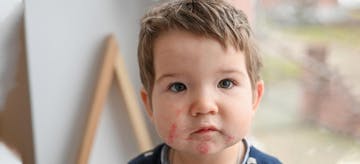 6 Jenis Bintik Merah Pada Pipi Bayi, Bagaimana Mengatasinya?