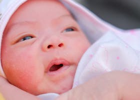 7 Cara Mengatasi Sariawan pada Bayi