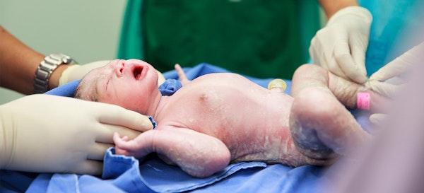 9 Hal Yang Dilakukan Bayi Selama Satu Jam Setelah Lahir