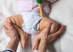 Anak Acha Sinaga Alami Hip Dysplasia, Rentan Terjadi Pada Bayi Sungsang!