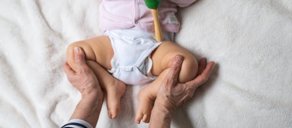 Anak Acha Sinaga Alami Hip Dysplasia, Rentan Terjadi Pada Bayi Sungsang!