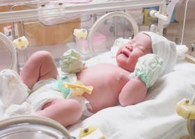 Berapa Usia Sebenarnya Bayi Prematur Anda?