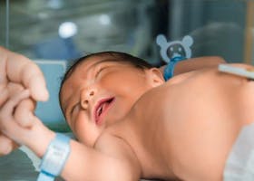 Cara Merawat Tali Pusat Bayi