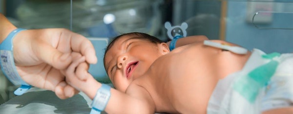 Cara Merawat Tali Pusat Bayi