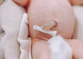 Ditunda Atau Tidak, Ini Anjuran Pemotongan Tali Pusat Pada Bayi Baru Lahir