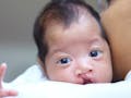 Genetik Dan Paparan Zat Berbahaya, Picu Bibir Sumbing Pada Bayi Baru Lahir