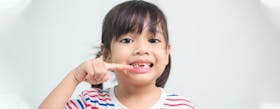 Gigi Tumbuh Dan Gigi Tanggal Pada Anak