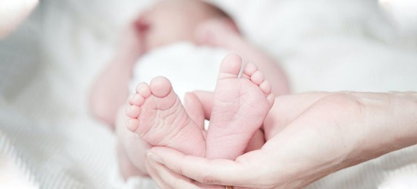 Kenali 5 Macam Tanda Lahir Pada Bayi