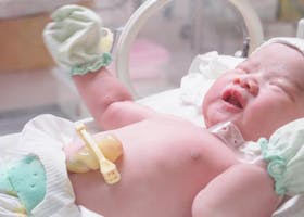 Kondisi Bayi Prematur yang Lahir pada Usia Kandungan 28, 31, 33, dan 36 Minggu