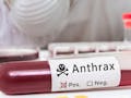 Konsumsi Bangkai Hewan Ternak, Waspada Risiko Penyakit Anthrax!