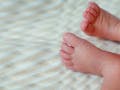 Kulit Bayi Kering dan Bersisik? Waspada Psoriasis Pada Bayi
