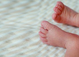 Kulit Bayi Kering dan Bersisik? Waspada Psoriasis Pada Bayi