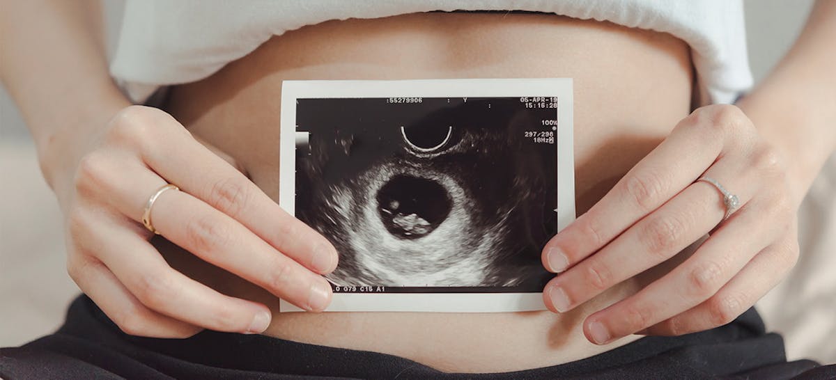 Manfaat Usg Untuk Ibu Hamil Dan Janin Ibupedia