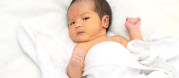 Mata Bayi Kuning Normal Terjadi, Yuk Kenali Penyebab Dan Cara Mengatasinya