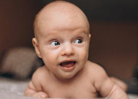 Mata Juling Pada Bayi, Normal Atau Tidak?