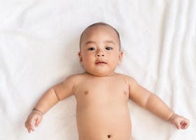 Cradle Cap: Ketombe Bayi Yang Tidak Berbahaya