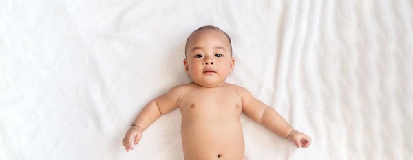 Cradle Cap: Ketombe Bayi Yang Tidak Berbahaya
