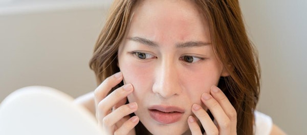 Nggak Bikin Break Out! 8 Rekomendasi Facial Wash Untuk Kulit Sensitif