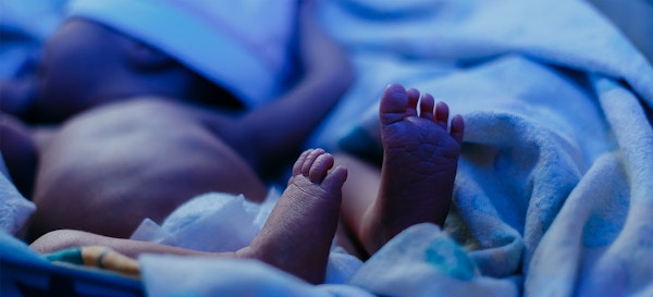 Penyakit Kuning Pada Bayi: Jenis, Cara Mengecek, dan Menanganinya