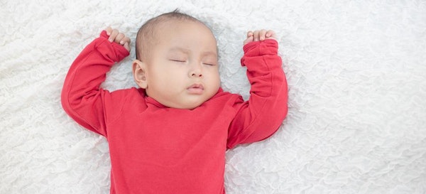 Penyebab Dan Cara Mengatasi Hiperhidrosis Pada Bayi 