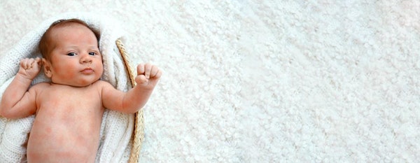 Pilih Krim yang Tepat sebagai Solusi Hilangkan Ruam pada Kulit Bayi