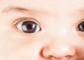 Strabismus dan Amblyopia: Dua Masalah Pada Mata Anak