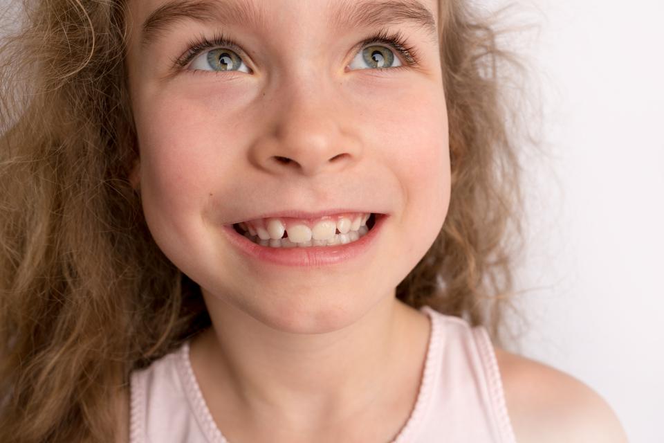 HatiHati! Gunakan Cara Tepat Mencabut Gigi Susu Anak Ini Ibupedia